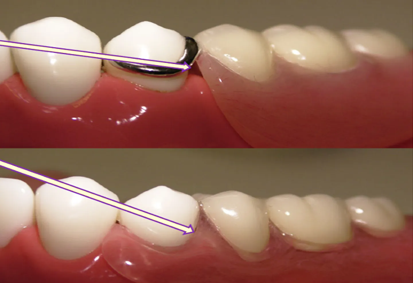 メリットその1:食べ物が詰まりにくい