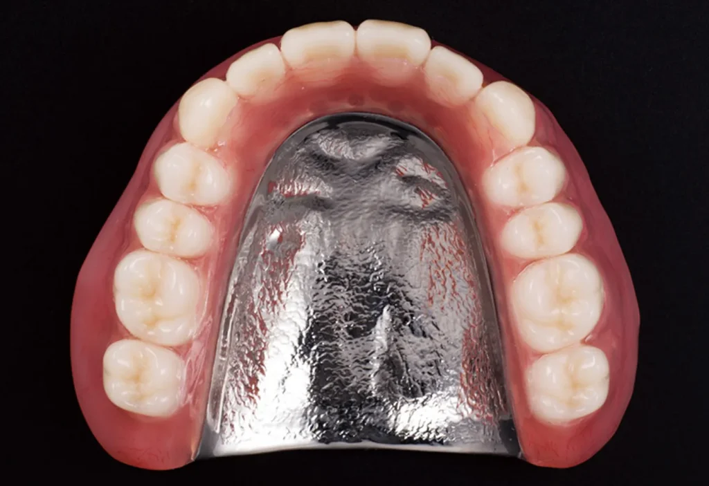 金属床義歯 (総義歯)