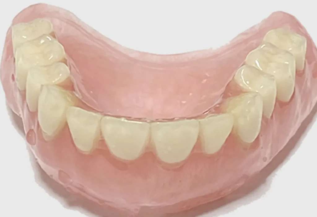 プラスチック義歯